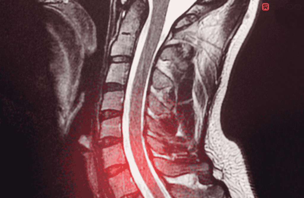 Réglages de chaise ergonomique pour la lordose et la cyphose